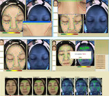 3d皮膚科学の顔の皮の分析機械顔の走査器の皮の検光子40W
