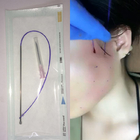 PDOの糸のHyaluronic酸の皮膚注入口の非外科糸の上昇30g 29g 25mm